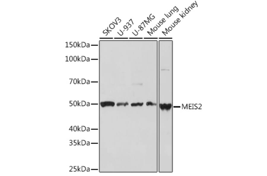 Western Blot - Anti-MEIS2 Antibody [ARC2049] (A306983) - Antibodies.com