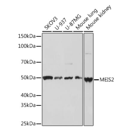 Western Blot - Anti-MEIS2 Antibody [ARC2049] (A306983) - Antibodies.com