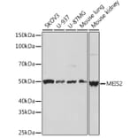 Western Blot - Anti-MEIS2 Antibody [ARC2049] (A306983) - Antibodies.com