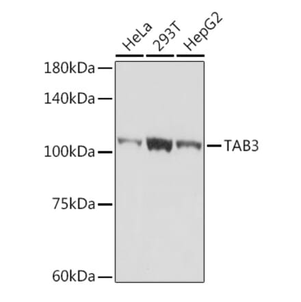 Western Blot - Anti-TAB3 Antibody [ARC2350] (A306984) - Antibodies.com