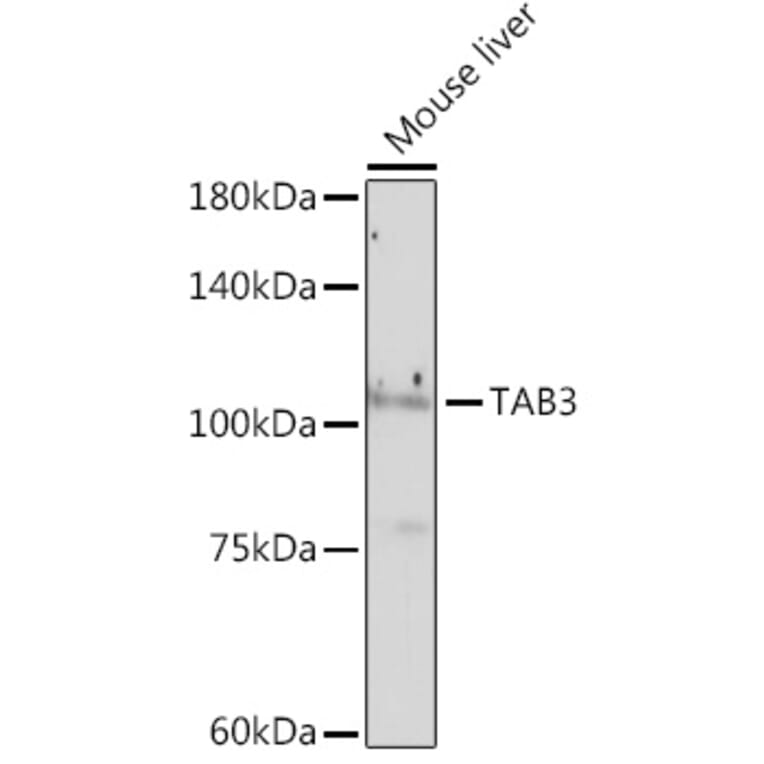 Western Blot - Anti-TAB3 Antibody [ARC2350] (A306984) - Antibodies.com