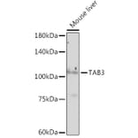 Western Blot - Anti-TAB3 Antibody [ARC2350] (A306984) - Antibodies.com