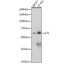 Western Blot - Anti-p73 Antibody [ARC2628] (A306985) - Antibodies.com