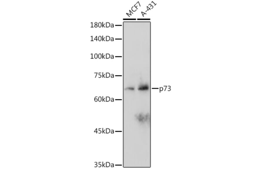 Western Blot - Anti-p73 Antibody [ARC2628] (A306985) - Antibodies.com