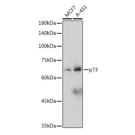 Western Blot - Anti-p73 Antibody [ARC2628] (A306985) - Antibodies.com