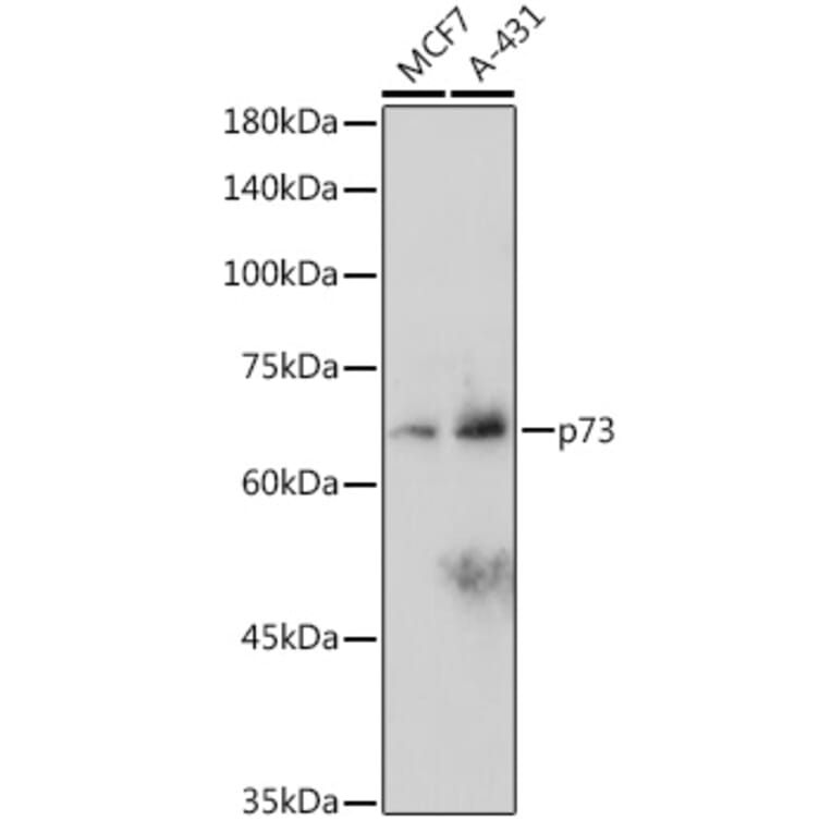 Western Blot - Anti-p73 Antibody [ARC2628] (A306985) - Antibodies.com