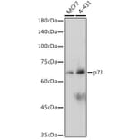Western Blot - Anti-p73 Antibody [ARC2628] (A306985) - Antibodies.com