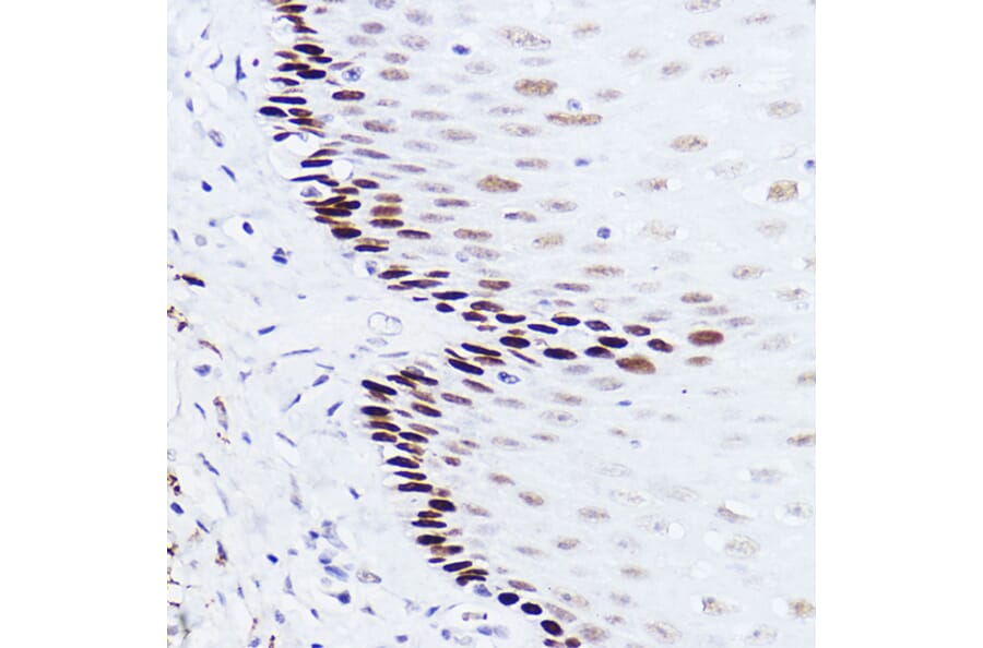 Immunohistochemistry - Anti-p73 Antibody [ARC2628] (A306985) - Antibodies.com