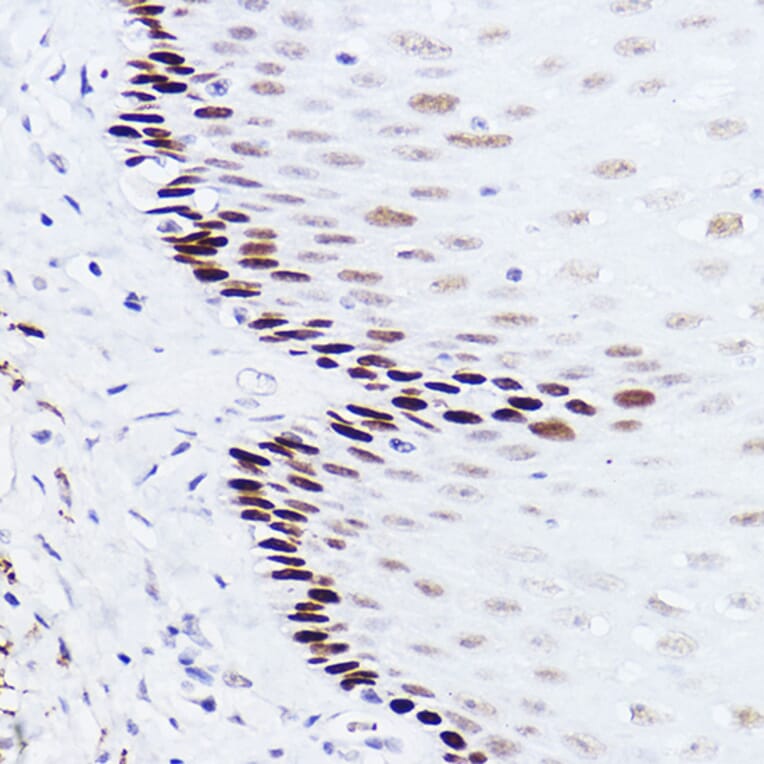 Immunohistochemistry - Anti-p73 Antibody [ARC2628] (A306985) - Antibodies.com