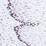 Immunohistochemistry - Anti-p73 Antibody [ARC2628] (A306985) - Antibodies.com