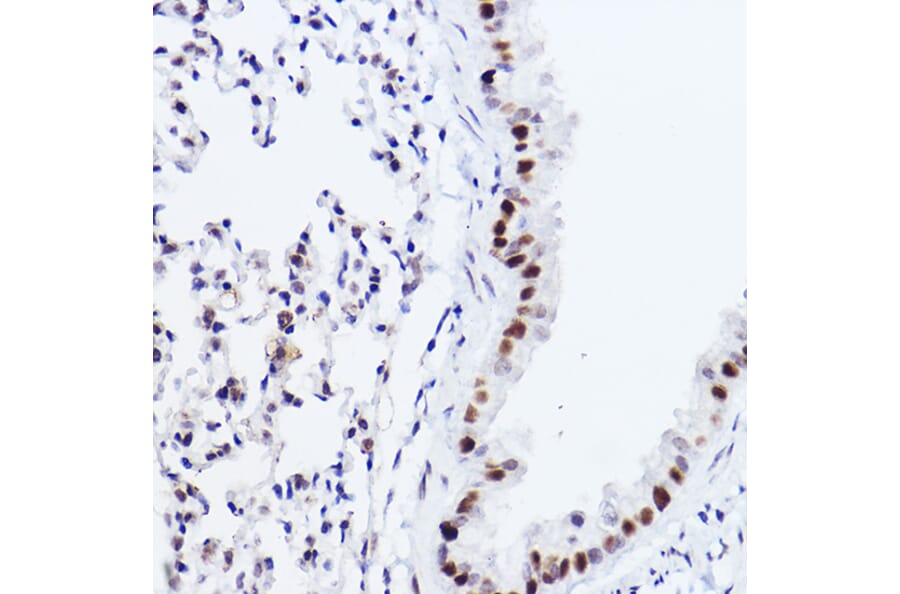 Immunohistochemistry - Anti-p73 Antibody [ARC2628] (A306985) - Antibodies.com