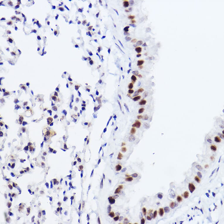 Immunohistochemistry - Anti-p73 Antibody [ARC2628] (A306985) - Antibodies.com