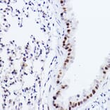 Immunohistochemistry - Anti-p73 Antibody [ARC2628] (A306985) - Antibodies.com