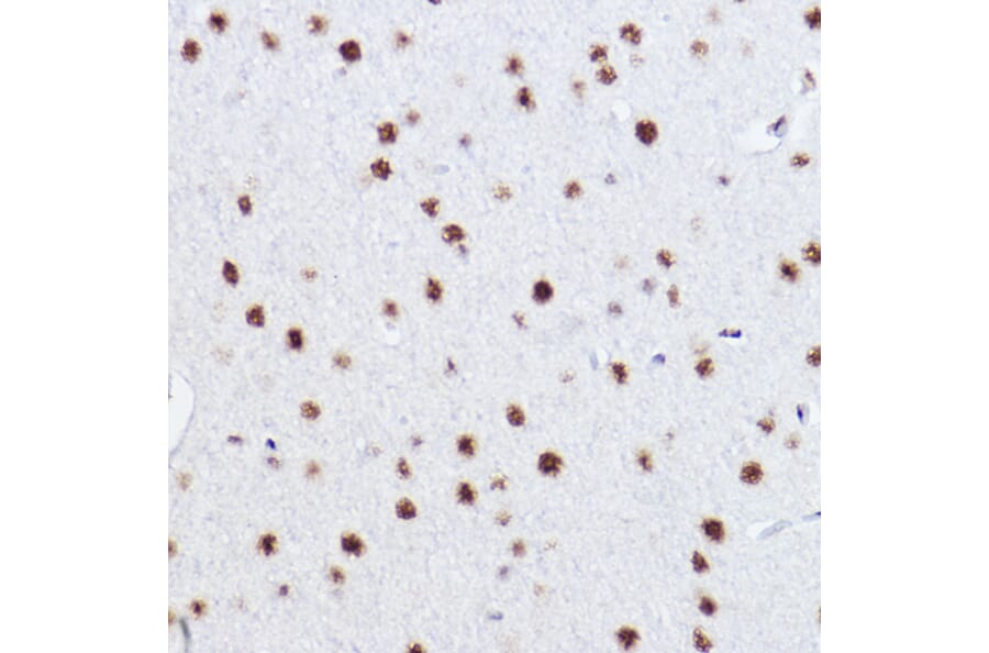 Immunohistochemistry - Anti-p73 Antibody [ARC2628] (A306985) - Antibodies.com