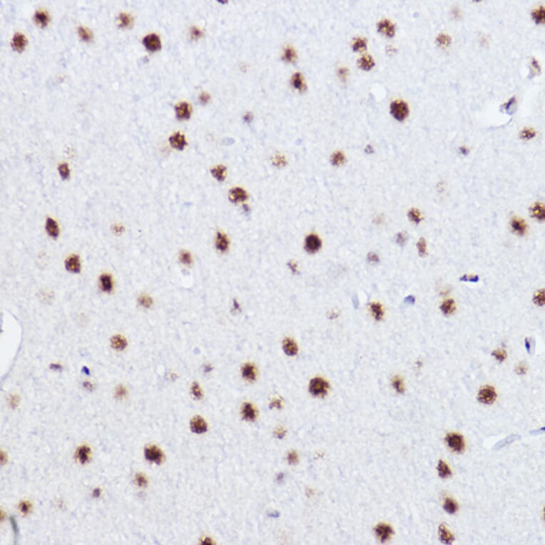 Immunohistochemistry - Anti-p73 Antibody [ARC2628] (A306985) - Antibodies.com