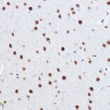 Immunohistochemistry - Anti-p73 Antibody [ARC2628] (A306985) - Antibodies.com