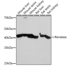 Western Blot - Anti-Renalase Antibody [ARC2324] (A306987) - Antibodies.com