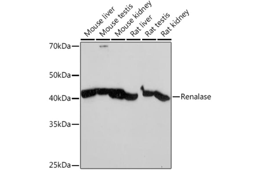 Western Blot - Anti-Renalase Antibody [ARC2324] (A306987) - Antibodies.com