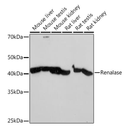 Western Blot - Anti-Renalase Antibody [ARC2324] (A306987) - Antibodies.com