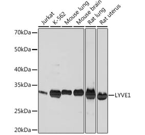 Western Blot - Anti-LYVE1 Antibody [ARC0974] (A306991) - Antibodies.com