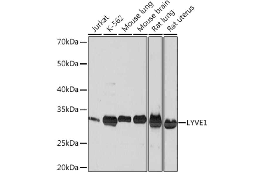 Western Blot - Anti-LYVE1 Antibody [ARC0974] (A306991) - Antibodies.com