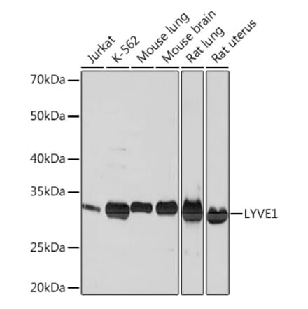 Western Blot - Anti-LYVE1 Antibody [ARC0974] (A306991) - Antibodies.com