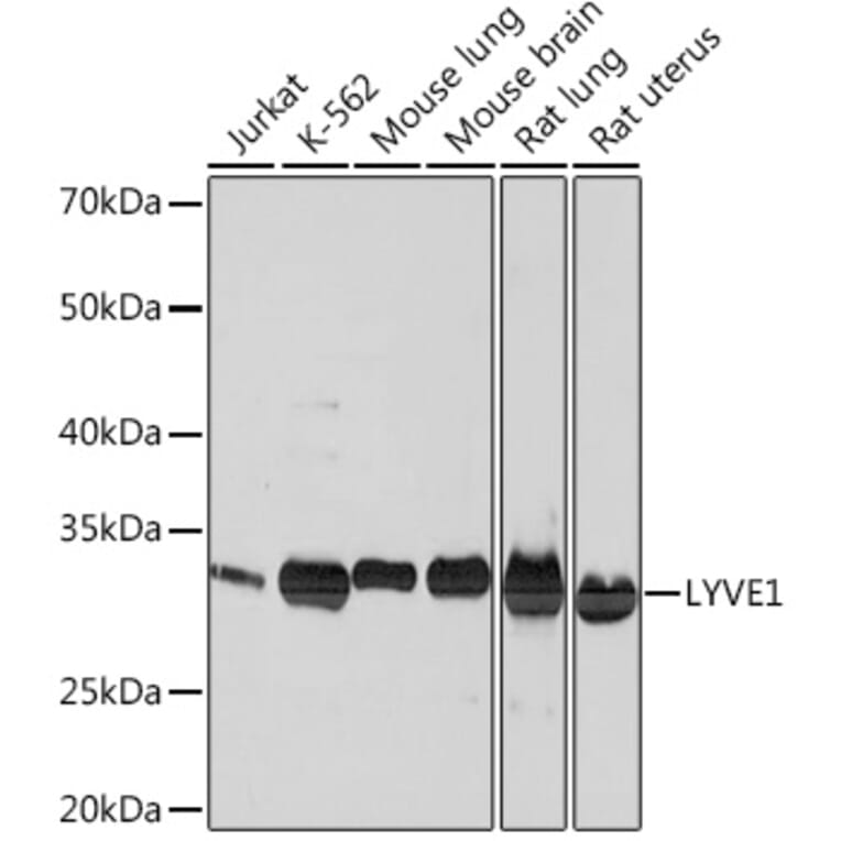 Western Blot - Anti-LYVE1 Antibody [ARC0974] (A306991) - Antibodies.com