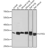 Western Blot - Anti-LYVE1 Antibody [ARC0974] (A306991) - Antibodies.com