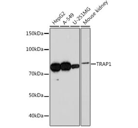 Western Blot - Anti-TRAP1 Antibody [ARC0876] (A306992) - Antibodies.com