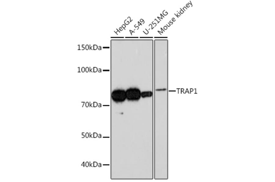 Western Blot - Anti-TRAP1 Antibody [ARC0876] (A306992) - Antibodies.com