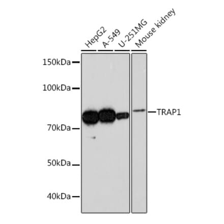 Western Blot - Anti-TRAP1 Antibody [ARC0876] (A306992) - Antibodies.com