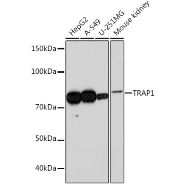 Western Blot - Anti-TRAP1 Antibody [ARC0876] (A306992) - Antibodies.com