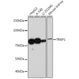 Western Blot - Anti-TRAP1 Antibody [ARC0876] (A306992) - Antibodies.com