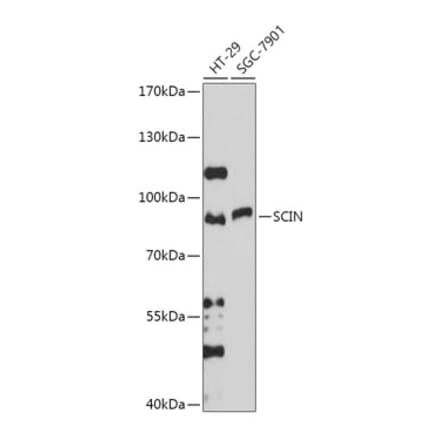 Western Blot - Anti-SCIN Antibody (A306993) - Antibodies.com