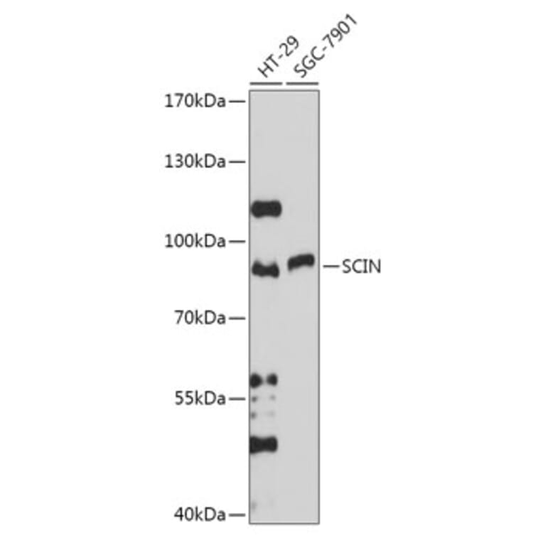 Western Blot - Anti-SCIN Antibody (A306993) - Antibodies.com