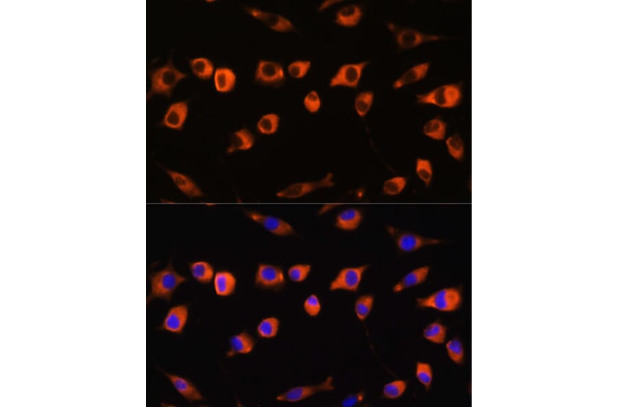 Immunofluorescence - Anti-SCIN Antibody (A306993) - Antibodies.com