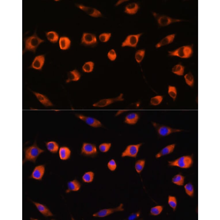 Immunofluorescence - Anti-SCIN Antibody (A306993) - Antibodies.com