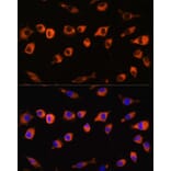 Immunofluorescence - Anti-SCIN Antibody (A306993) - Antibodies.com