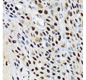 Immunohistochemistry - Anti-ENT2 Antibody [ARC2234] (A306994) - Antibodies.com