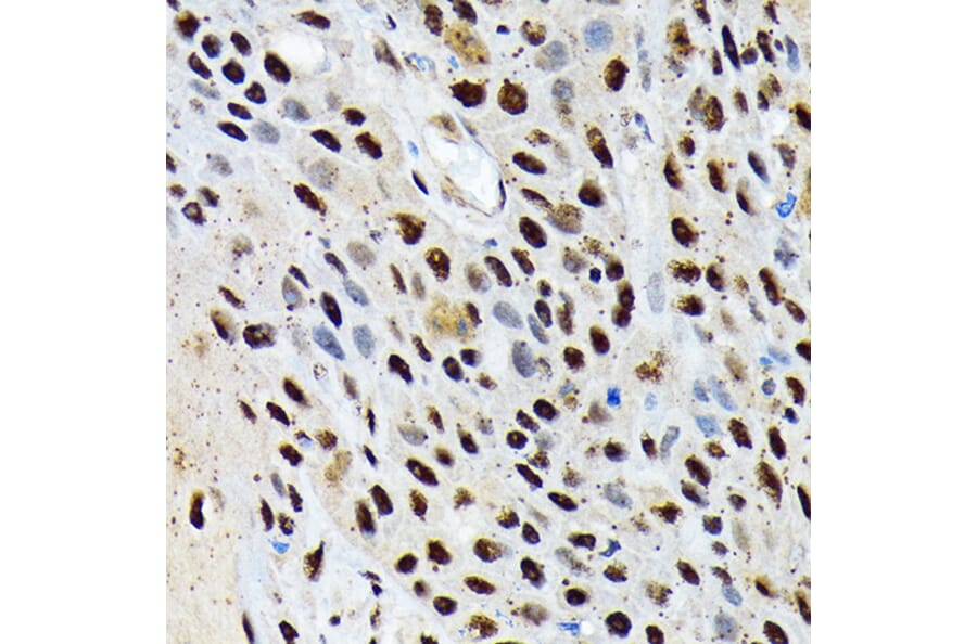 Immunohistochemistry - Anti-ENT2 Antibody [ARC2234] (A306994) - Antibodies.com