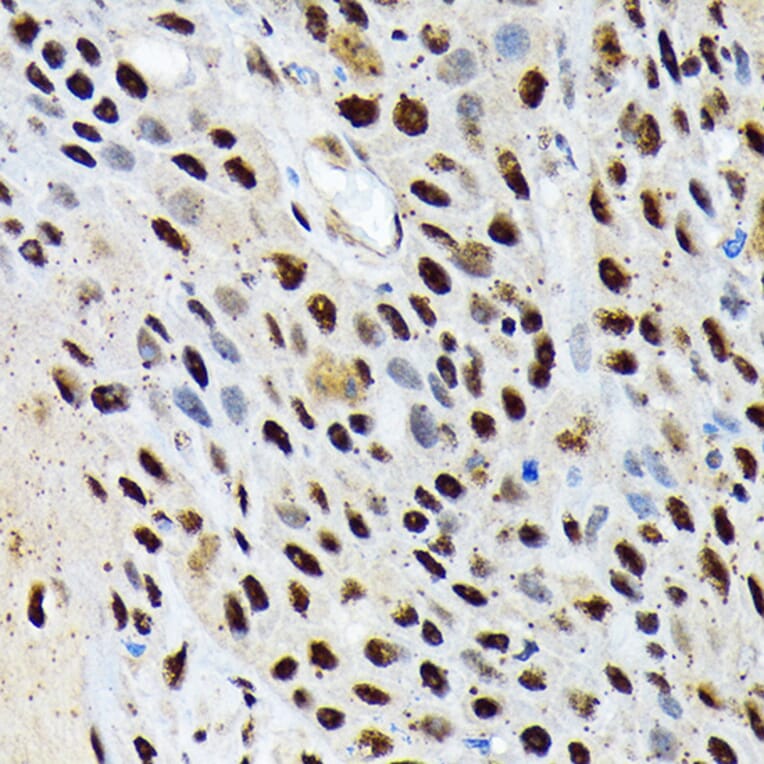 Immunohistochemistry - Anti-ENT2 Antibody [ARC2234] (A306994) - Antibodies.com