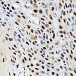 Immunohistochemistry - Anti-ENT2 Antibody [ARC2234] (A306994) - Antibodies.com