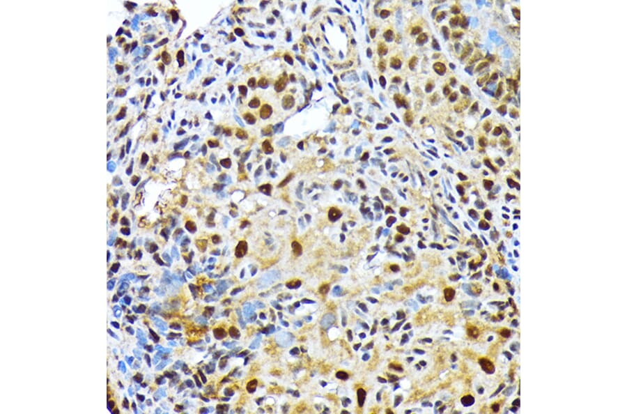 Immunohistochemistry - Anti-ENT2 Antibody [ARC2234] (A306994) - Antibodies.com