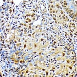 Immunohistochemistry - Anti-ENT2 Antibody [ARC2234] (A306994) - Antibodies.com