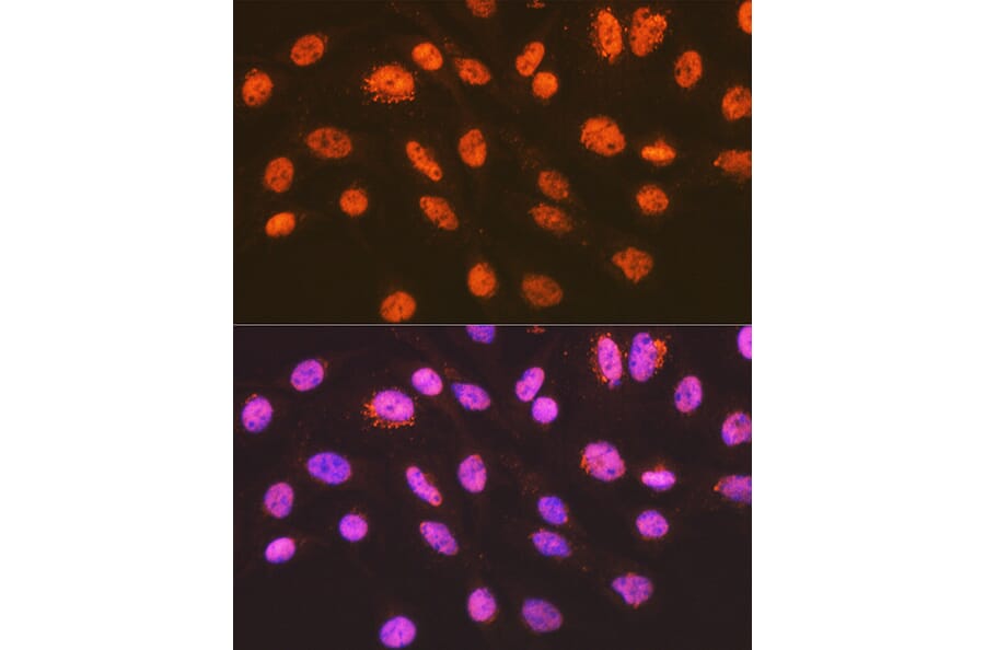 Immunofluorescence - Anti-ENT2 Antibody [ARC2234] (A306994) - Antibodies.com
