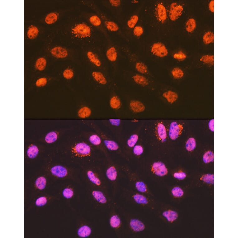 Immunofluorescence - Anti-ENT2 Antibody [ARC2234] (A306994) - Antibodies.com