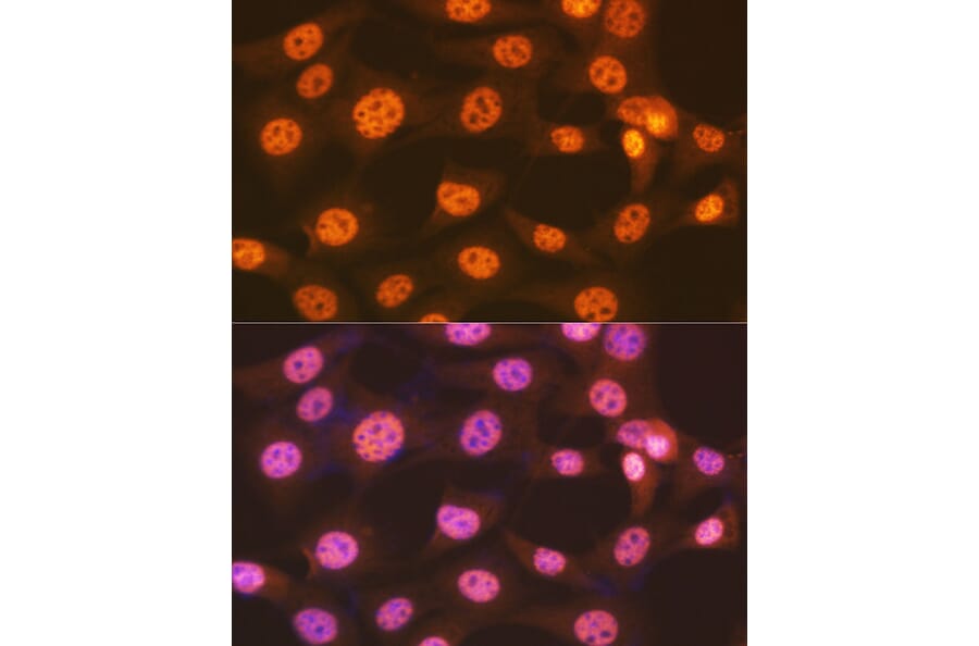 Immunofluorescence - Anti-ENT2 Antibody [ARC2234] (A306994) - Antibodies.com