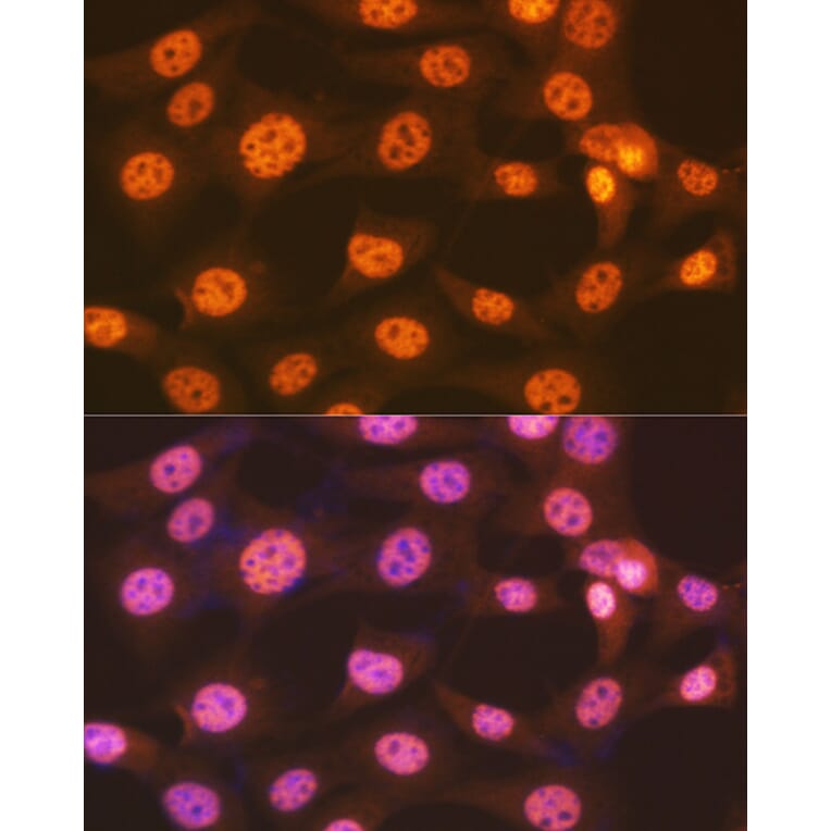 Immunofluorescence - Anti-ENT2 Antibody [ARC2234] (A306994) - Antibodies.com