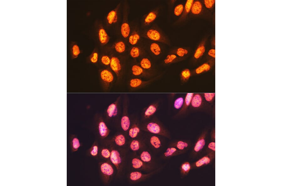Immunofluorescence - Anti-ENT2 Antibody [ARC2234] (A306994) - Antibodies.com
