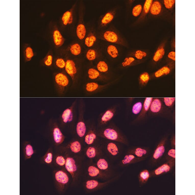 Immunofluorescence - Anti-ENT2 Antibody [ARC2234] (A306994) - Antibodies.com